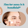 Zinc for acne: is it beneficial?